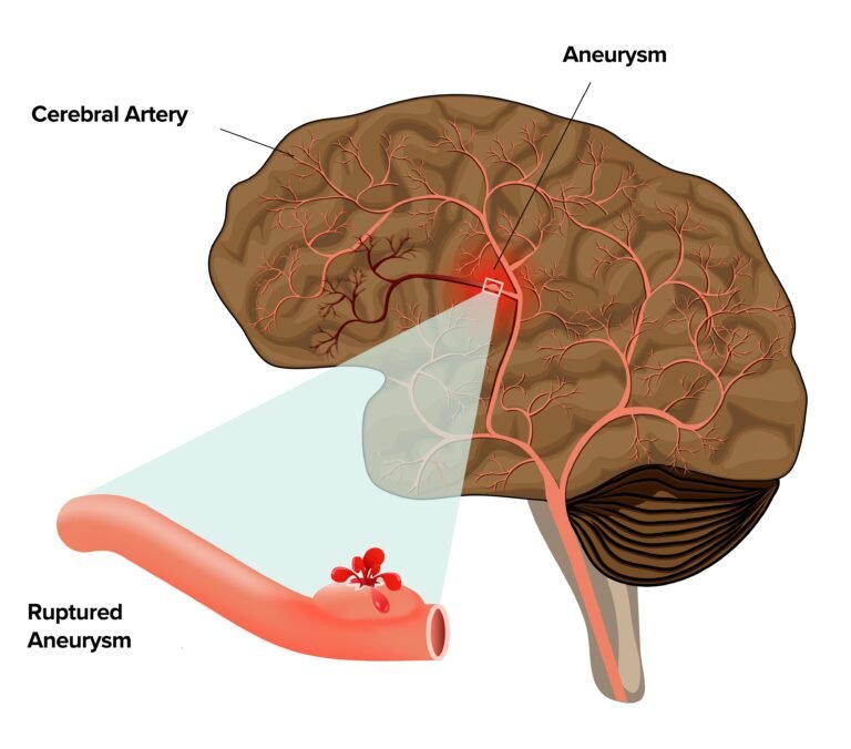 Neurosurgeon Near Me
