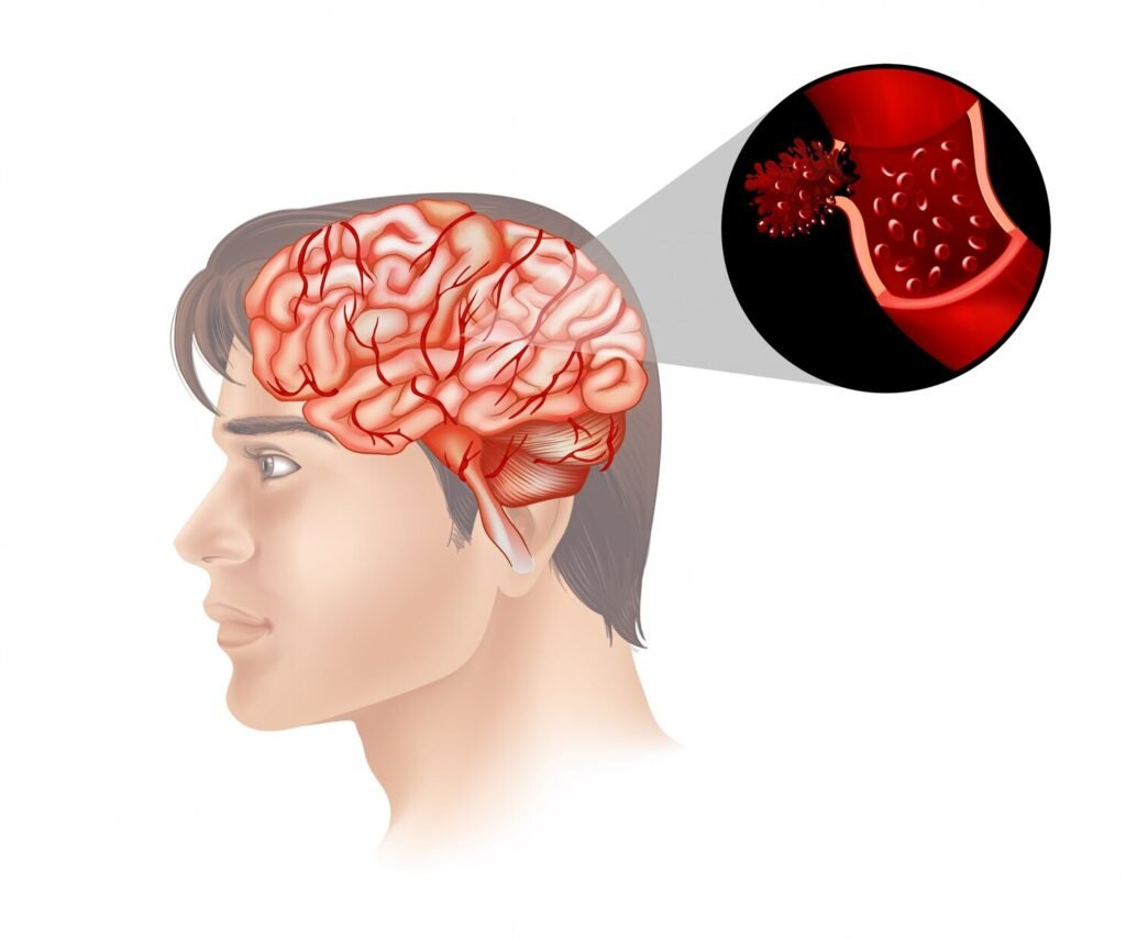 neurosurgeon doctor in indore
