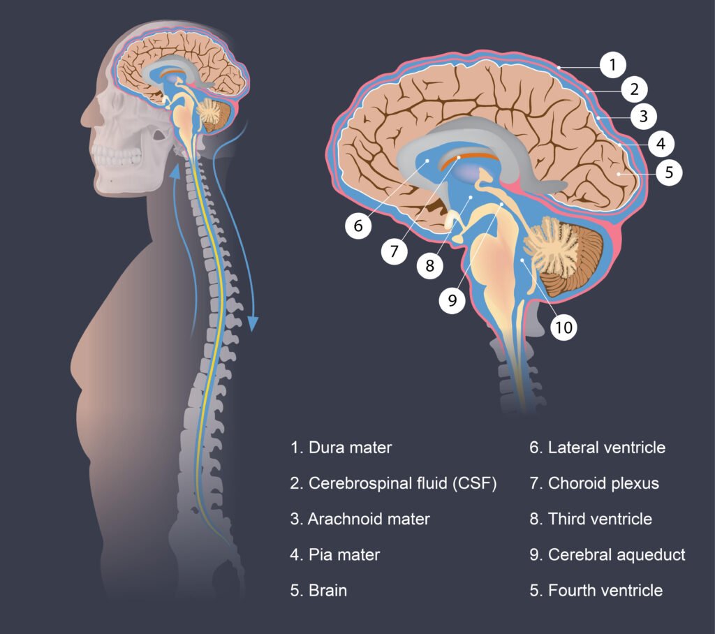 Cerebral Spinal Fluid (CSF) Disorders