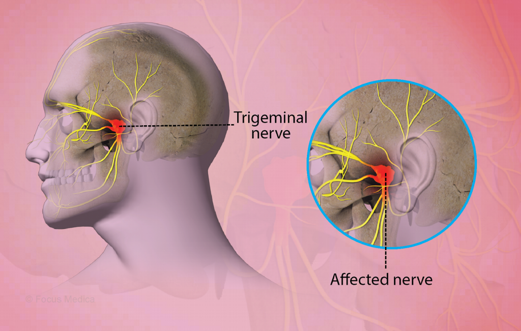Best Neuro Specialist Near Me