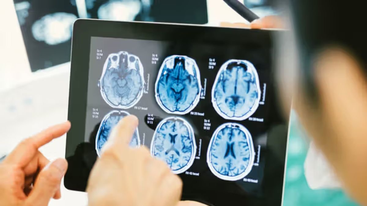 brain tumour