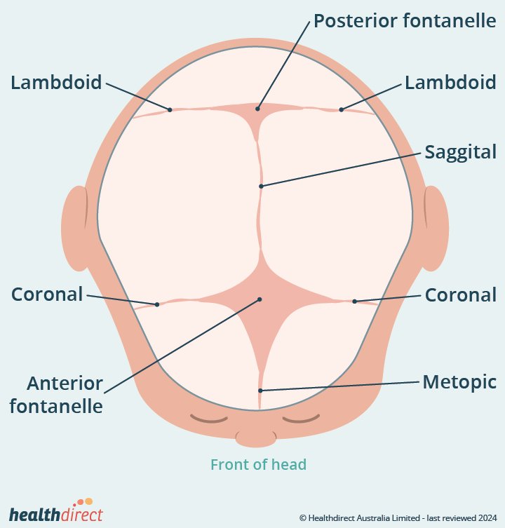 Craniosynostosis