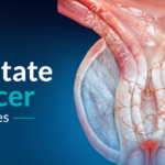 Best Uro Cancer Surgeon in Indore