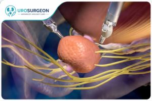 Best Uro Cancer Surgeon in Indore
