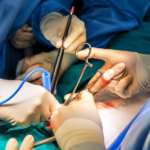 Best Uro Cancer Surgeon in Indore