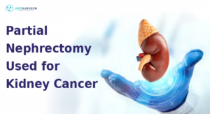 Best Uro Cancer Surgeon in Indore