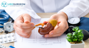 Best Uro Cancer Surgeon in Indore